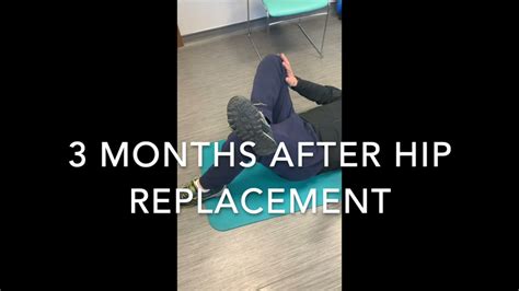 Recovery After Total Hip Replacement Dual Mobility Youtube