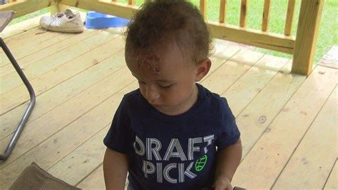 Millbrook Daycare Shuts Down After Toddler Burned Other Violations