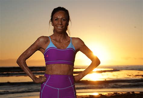 Turia Pitt Says Running Will Help Us Gain Confidence