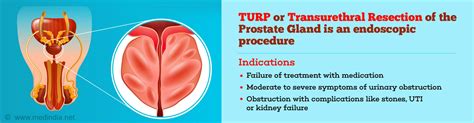 Transurethral Resection Of Prostate Turp For Prostate Enlargement