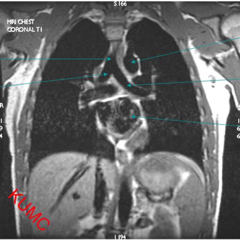 Mri Chest Diagram Quizlet