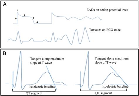 A Demonstrates Prolongation Of The Ventricular Action Potential With