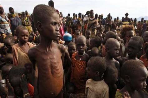 Um milhão de crianças africanas sofrem com desnutrição aguda grave A fome extrema é a principal