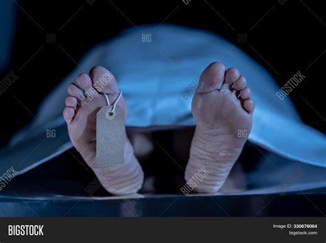 Cadaver On Autopsy Image And Photo Free Trial Bigstock