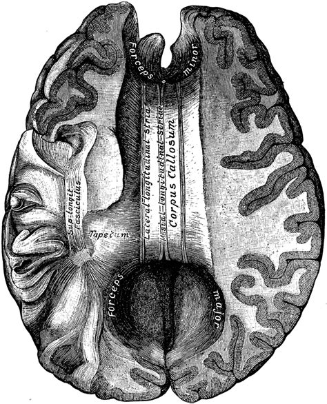 Brain Showing Corpus Callosum Clipart Etc