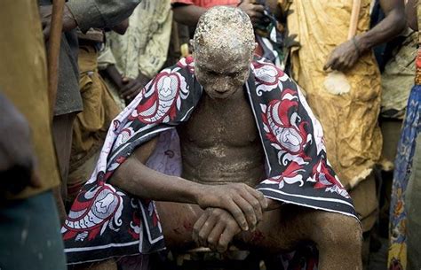 Circumcision Ceremony In Eastern Uganda