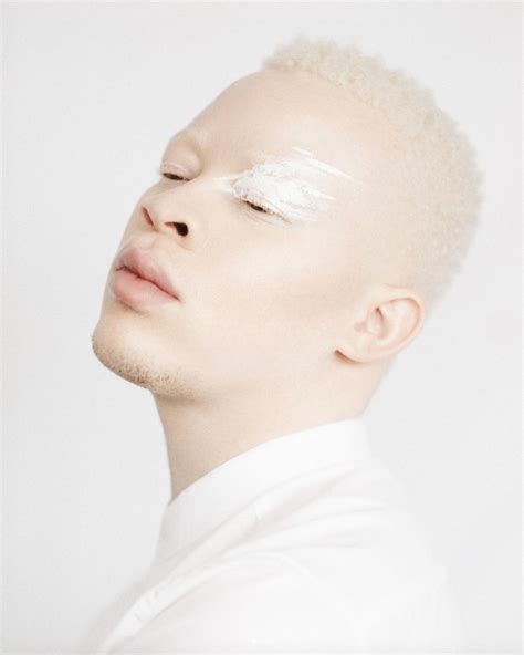 Albino African Model