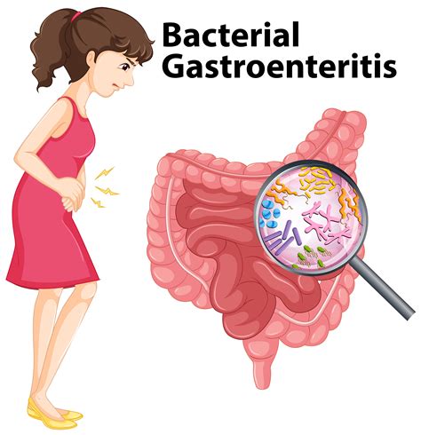 Diagram Showing Bacterial Gastroenteritis In Human 416600 Vector Art At