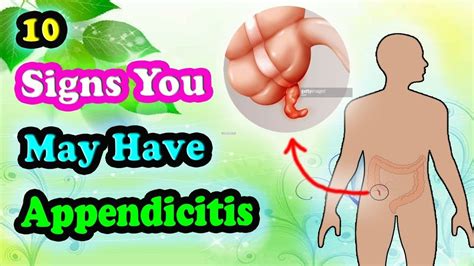 Dont Ignore These Early Symptoms Of Appendicitis Appendicitis