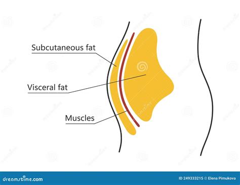 Visceral And Subcutaneous Fat Around Waistline Location Of Visceral