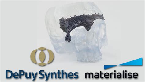 Johnson And Johnson Gets In On 3d Printing With Materialise Deal For