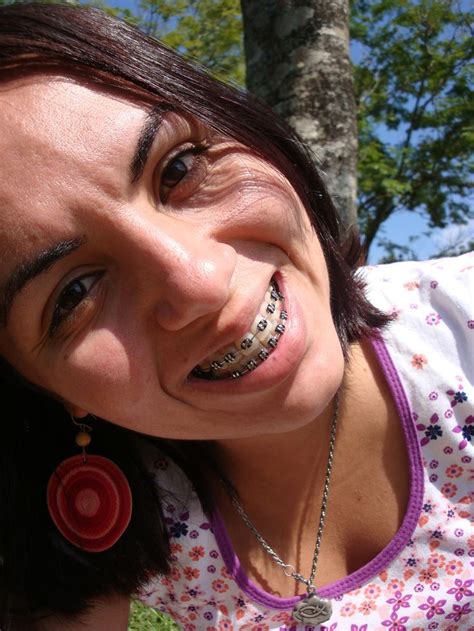 Pin By John Beeson On Girls In Braces Perfect Teeth Metal Braces Orthodontics Braces