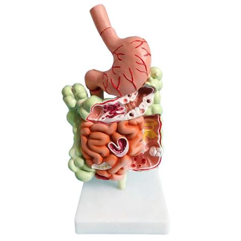 Buy Josenidny Human Digestive System Model Stomach Anatomy Intestine Cecum Rectum Duodenum Human