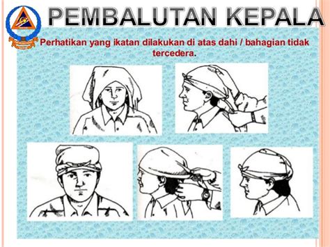 Anduh terdapat 5 jenis balutan anduh: Power point pertolongan cemas