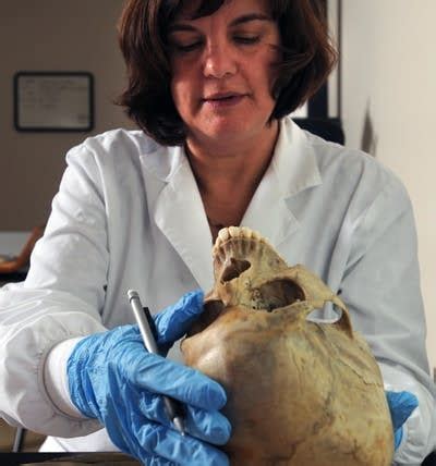 The back of the head (bone). The woman who gives bones back their names | MPR News