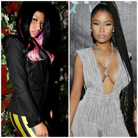 See Nicki Minaj Before And After Butt Implants And Nose Job Rumors