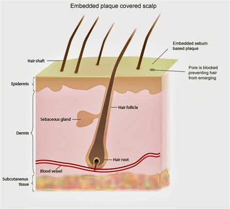 How To Make Hair Grow Why Clogged Hair Follicle On Scalp Thins Your