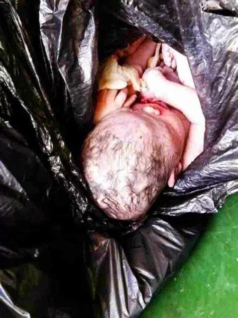 Mungkin anda boleh cuba berdiri atau berbaring dengan keadaan kaki sedang mengangkang. SUBHANALLAH, MAYAT BAYI DIBUANG DALAM TONG SAMPAH BERBAU ...