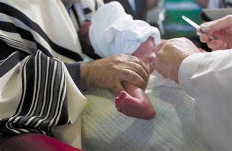Israeli Baby Requires Complex Surgery After Circumcision Gone Wrong