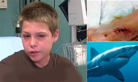 11 Year Old Boy Bitten By A Shark While Swimming On Memorial Day