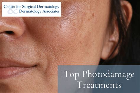 Top Photodamage Treatments Center For Surgical Dermatology