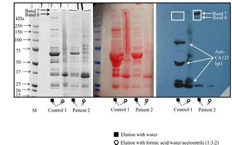 Sds Page And Western Blot Identification Of Ca125 Elution Of Ca125