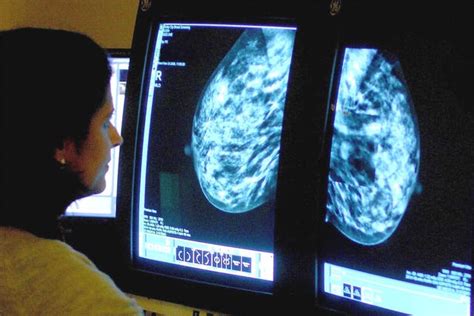 New Test Allows Surgeons To Detect Spread Of Breast Cancer Tumours