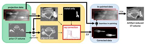 Applied Sciences Free Full Text Metal Artifact Reduction In X Ray