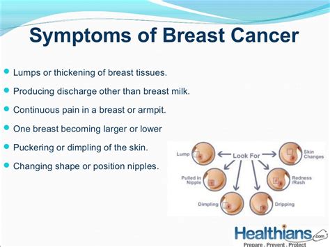 Breast Cancer Symptoms Precautions And Preventive Check Ups Health