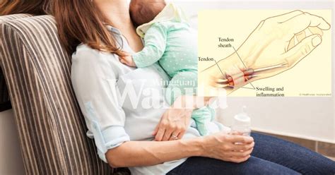 Maybe you would like to learn more about one of these? DeQuervain's Tenosynovitis, Sakit Dekat Pergelangan Tangan ...