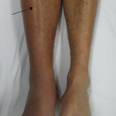 Here are a few simple tips to help you avoid that feeling bloated after a flight seems like something you just have to accept when you travel. Swollen ankles after long drive - ALQURUMRESORT.COM
