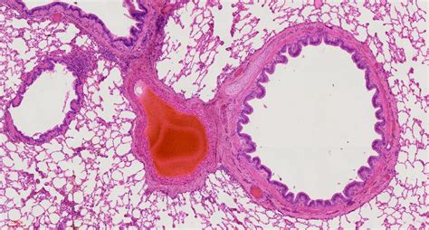 Histology Of Lung Labeled Sexiz Pix