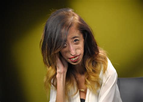 Lizzie Velasquez Once Dubbed ‘world’s Ugliest Woman ’ Shares How She Reclaimed Her Life From