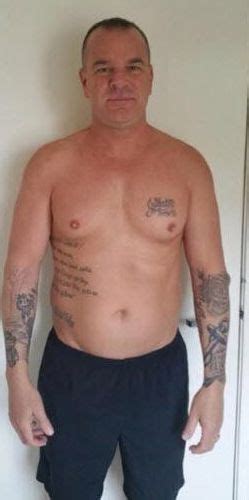 Patient 282 Testosterone Replacement Therapy Before And After Photos