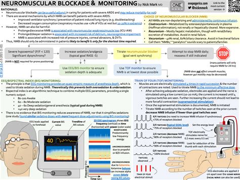 Neuromuscular Blockers Eeg Bispectral Index And Train Of Four