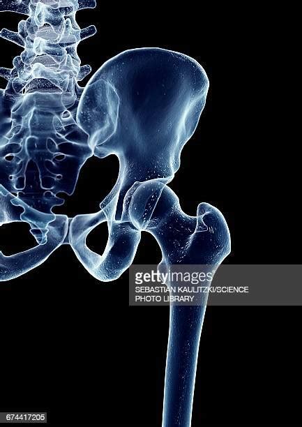 Hips Skeleton Photos And Premium High Res Pictures Getty Images