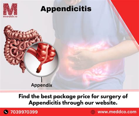 Appendectomy Symptomscauses And Treatment