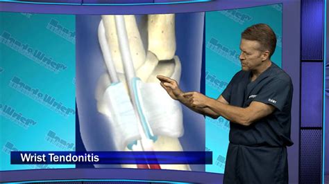Tennis elbow pain originates at the outside of the elbow but can radiate downward into the forearm or the wrist. HAWTV Ep. 2 - Tennis Wrist Injuries and Prevention - YouTube