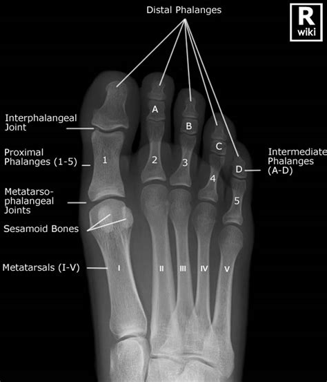 Toes Radiographic Anatomy Wikiradiography