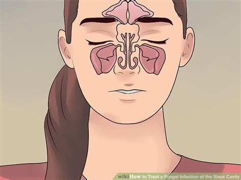 A mucus sample is sent to a laboratory where it is examined for signs of fungi. How to get rid of fungal sinus infection > ALQURUMRESORT.COM