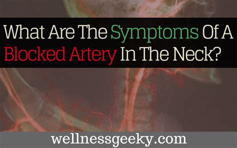 What Are The Symptoms Of A Blocked Artery In The Neck