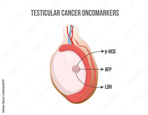 Testis Tumor Markers Testicular Cancer Releasing Hormones And Enzymes Stock Vector Adobe Stock