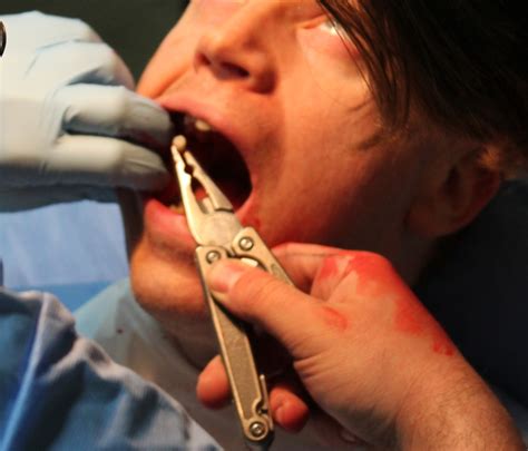 Recap Diy Dentistry Class I3detroit