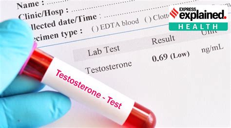 Explained Testosterone Deficiency And The Safety Of Replacement