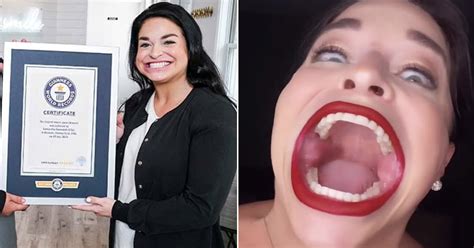 This Woman Earns Guinness World Record For Having The Largest Mouth Gag