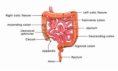 Intestine Anus Appendix Through Pull Fistulotomy Procedure