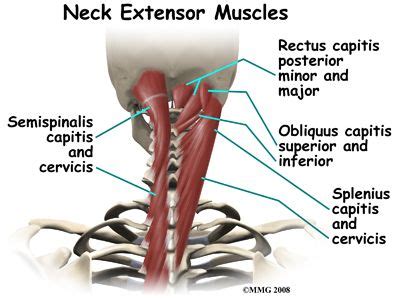 The most widely recognized wellsprings of neck torment are whiplash, cervical herniated circles, cervical spinal stenosis, osteoarthritis, or cervical adenitis. Pin on health.........is not an option