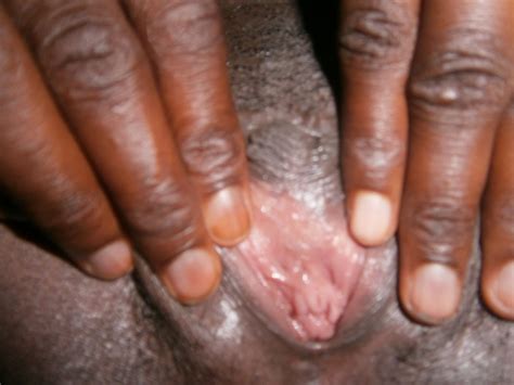 African Pussy Circumcision