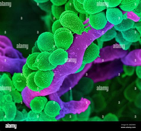 Las Bacterias Estreptococos Orales Color Análisis Micrografía De