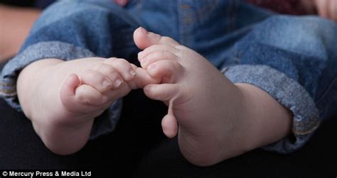 Baby Babe Born With Fingers And Toes Leaving Doctors Clueless Daily Mail Online
